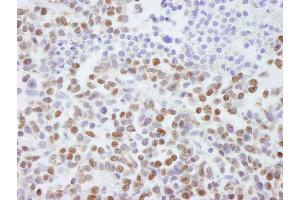Immunohistochemistry (IHC) image for anti-Scaffold Attachment Factor B2 (SAFB2) (AA 175-225) antibody (ABIN7448785) (SAFB2 抗体  (AA 175-225))