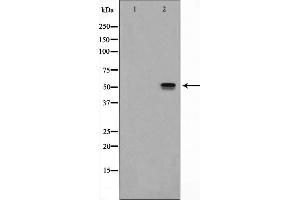 Western blot analysis on HeLa cell lysate using ITPK1 Antibody,The lane on the left is treated with the antigen-specific peptide. (ITPK1 抗体  (Internal Region))