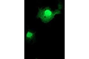 Anti-FXN mouse monoclonal antibody (ABIN2455598) immunofluorescent staining of COS7 cells transiently transfected by pCMV6-ENTRY FXN (RC204880). (Frataxin 抗体)