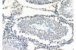 ABIN6258041 and ABIN6273478 at 1/100 staining Rat testis tissue by IHC-P. (CYLC2 抗体  (C-Term))