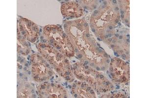 Used in DAB staining on fromalin fixed paraffin- embedded kidney tissue (ACP6 抗体  (AA 33-413))