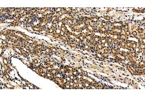 Detection of IRAK4 in Mouse Kidney Tissue using Polyclonal Antibody to Interleukin 1 Receptor Associated Kinase 4 (IRAK4) (IRAK4 抗体  (AA 189-427))