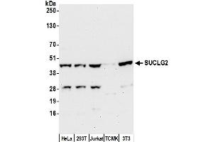 Western Blotting (WB) image for anti-Succinate-CoA Ligase, GDP-Forming, beta Subunit (SUCLG2) (AA 382-432) antibody (ABIN7449836)