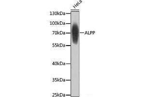 Western blot analysis of extracts of HeLa cells using ALPP Polyclonal Antibody at dilution of 1:1000. (PLAP 抗体)