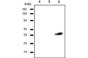 Western Blotting (WB) image for anti-Ras Association (RalGDS/AF-6) Domain Family Member 1 (RASSF1) antibody (ABIN165456) (RASSF1 抗体)