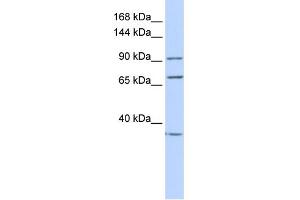 WB Suggested Anti-EEF2 Antibody Titration: 0. (EEF2 抗体  (N-Term))