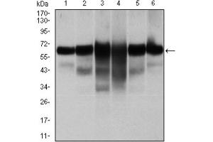 Western blot analysis using CK5 antibody against human CK5 (AA: 158-272) recombinant protein. (Cytokeratin 5 抗体)