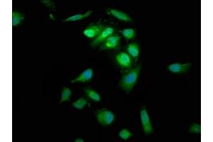 Immunofluorescence staining of Hela cells with ABIN7166237 at 1:66, counter-stained with DAPI. (PTP4A2 抗体  (AA 1-164))