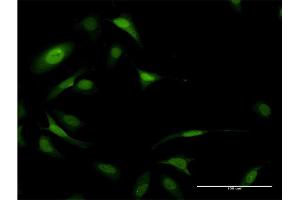 Immunofluorescence (IF) image for anti-Eukaryotic Translation Initiation Factor 5A (EIF5A) (AA 1-154) antibody (ABIN947825)