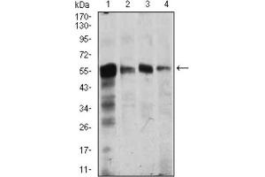 Immunofluorescence analysis of HepG2 cells using CAMK4 antibody (green). (CAMK4 抗体  (AA 35-292))