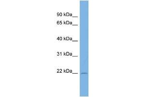 WB Suggested Anti-C13orf28 Antibody Titration: 0. (SPACA7 抗体  (Middle Region))