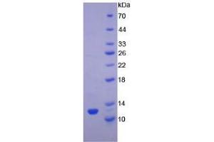 SDS-PAGE analysis of Rat TGFa Protein. (TGFA 蛋白)