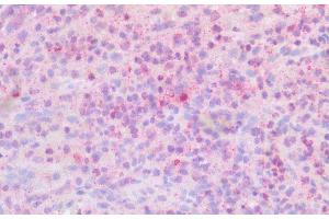 Detection of PLCb2 in Human Spleen Tissue using Polyclonal Antibody to Phospholipase C Beta 2 (PLCb2) (Phospholipase C beta 2 抗体  (AA 1-250))