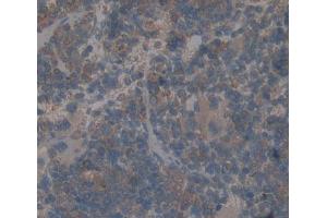 Used in DAB staining on fromalin fixed paraffin- embedded Kidney tissue (CD7 抗体  (AA 26-134))