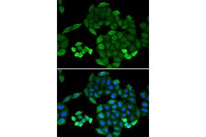 Immunofluorescence (IF) image for anti-6-Pyruvoyltetrahydropterin Synthase (PTS) antibody (ABIN1980322) (PTS 抗体)