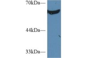 Western Blotting (WB) image for anti-Pyruvate Kinase M2 (PKM2) (AA 141-248) antibody (ABIN7432133)