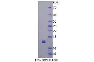 SDS-PAGE analysis of Human CDK2AP1 Protein. (CDK2AP1 蛋白)