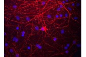 Immunostaining of cultured rat neurons and glia showing labeling of NF-M in red. (NEFM 抗体  (C-Term))