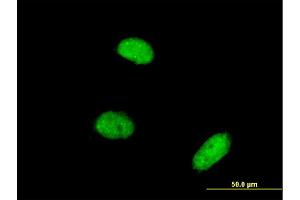 Immunofluorescence of monoclonal antibody to AKIRIN2 on HeLa cell. (AKIRIN2 抗体  (AA 1-203))
