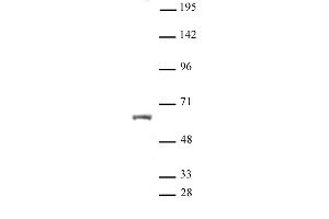 HNF4A antibody (pAb) tested by Western blot. (HNF4A 抗体  (N-Term))