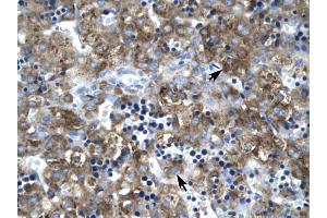 Claudin 1 antibody was used for immunohistochemistry at a concentration of 4-8 ug/ml to stain Hepatocytes (arrows) in Human Liver.