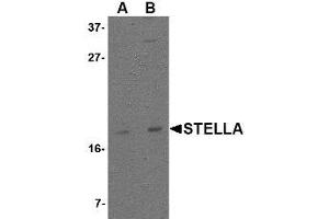 Image no. 1 for anti-Developmental Pluripotency Associated 3 (DPPA3) (C-Term) antibody (ABIN342700) (DPPA3 抗体  (C-Term))