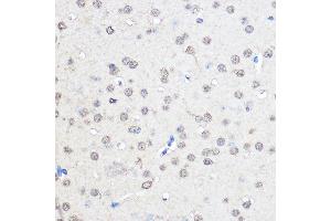 Immunohistochemistry of paraffin-embedded Mouse brain using CNOT7 Rabbit pAb (ABIN6127563, ABIN6138783, ABIN6138784 and ABIN6224834) at dilution of 1:50 (40x lens). (CNOT7 抗体  (AA 90-160))