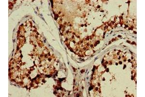 Immunohistochemistry of paraffin-embedded human testis tissue using ABIN7171602 at dilution of 1:100 (TBC1D15 抗体  (AA 283-404))