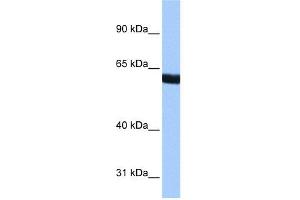 WB Suggested Anti-ZNF350 Antibody Titration:  0. (ZNF350 抗体  (N-Term))