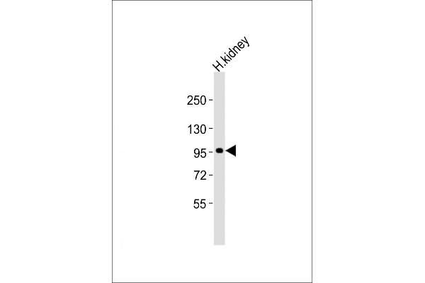 ADAMTS6 抗体  (AA 20-54)