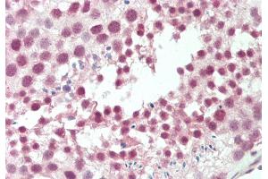 Immunohistochemistry (IHC) image for anti-Cleavage Stimulation Factor, 3' Pre-RNA, Subunit 2, 64kDa (CSTF2) (N-Term) antibody (ABIN2778764)