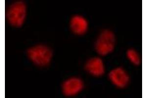 Immunofluorescence (fixed cells) (IF/ICC) image for anti-BTB and CNC Homology 1, Basic Leucine Zipper Transcription Factor 1 (BACH1) (Internal Region) antibody (ABIN6260184)