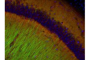Immunohistochemistry (IHC) image for anti-Catenin, beta (CATNB) (AA 768-782) antibody (ABIN1742544) (beta Catenin 抗体  (AA 768-782))
