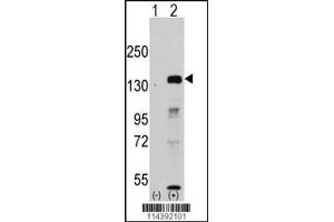 Western blot analysis of JHDM1a/FBXL11 using rabbit polyclonal JHDM1a/FBXL11 Antibody. (KDM2A 抗体  (AA 500-527))
