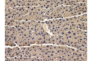 ABIN6257497 and ABIN6275601 at 1/100 staining mouse liver tissue by IHC-P. (Sorting Nexin 3 抗体  (Internal Region))