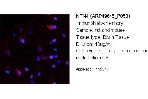 Image no. 2 for anti-Netrin 4 (NTN4) (N-Term) antibody (ABIN2783832) (Netrin 4 抗体  (N-Term))