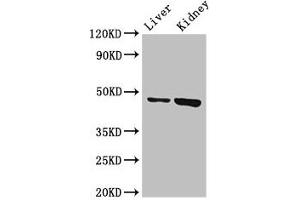Western Blot Positive WB detected in: Mouse liver tissue, Mouse kidney tissue All lanes: WDFY1 antibody at 3 μg/mL Secondary Goat polyclonal to rabbit IgG at 1/50000 dilution Predicted band size: 47 kDa Observed band size: 47 kDa (WDFY1 抗体  (AA 261-357))