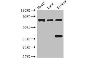 Western Blot Positive WB detected in: Mouse heart tissue, Mouse lung tissue, Mouse kidney tissue All lanes: BRSK1 antibody at 3. (BRSK1 抗体  (AA 426-591))