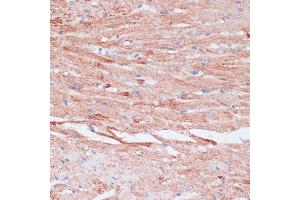 Immunohistochemistry (IHC) image for anti-Vasodilator-Stimulated phosphoprotein (VASP) (AA 1-100) antibody (ABIN6150064)