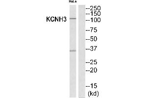 Western blot analysis of extracts from HeLa cells, using KCNH3 antibody. (KCNH3 抗体  (Internal Region))