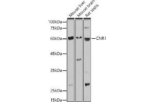 Western blot analysis of extracts of various cell lines, using CNR1 antibody (ABIN1679303, ABIN3015494, ABIN3015496 and ABIN6218536) at 1:1000 dilution. (CNR1 抗体  (AA 1-120))