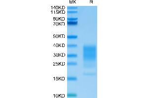 SDS-PAGE (SDS) image for Interleukin 22 (IL22) (AA 34-179) protein (His tag) (ABIN7274919)