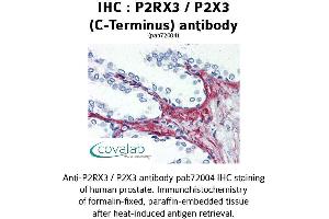 Image no. 2 for anti-Purinergic Receptor P2x, Ligand-Gated Ion Channel, 3 (P2RX3) (C-Term), (Cytoplasmic Domain) antibody (ABIN1737742) (P2RX3 抗体  (C-Term, Cytoplasmic Domain))