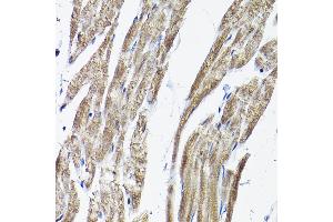 Immunohistochemistry (IHC) image for anti-Receptor (G Protein-Coupled) Activity Modifying Protein 2 (RAMP2) (AA 1-145) antibody (ABIN3017321)