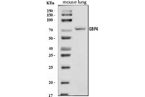 Western blot analysis of Gbp4 using anti-Gbp4 antibody (ABIN7602622).