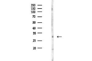Western blot analysis of lysates from Hela cells(UV 30 min treatment), using MIBP1 Antibody at 1/1000 dilution.