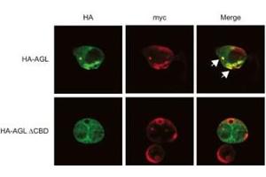 Expression of myc-GS causes wild type but not the ACBD mutant of AGL to aggregate around the S-stain-positive inclusions. (AGL 抗体  (N-Term))