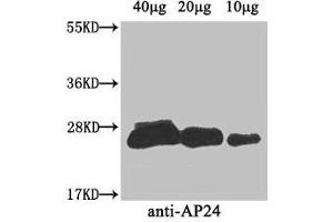 Western Blot Positive WB detected in: Nicotiana tabacum (40 μg, 20 μg, 10 μg) All lanes: AP24 antibody at 3 μg/mL Secondary Goat polyclonal to rabbit IgG at 1/50000 dilution Predicted band size: 27 kDa Observed band size: 27 kDa (AP24 (AA 22-246) 抗体)