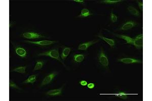 Immunofluorescence of purified MaxPab antibody to EPHX1 on HeLa cell. (EPHX1 抗体  (AA 1-455))