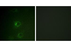 Peptide - +Immunofluorescence analysis of COS7 cells, using CBL (Ab-700) antibody. (CBL 抗体  (Tyr700))